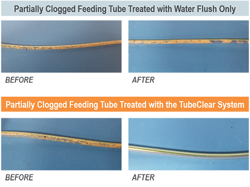 Feeding tubes before and after being cleared by different methods