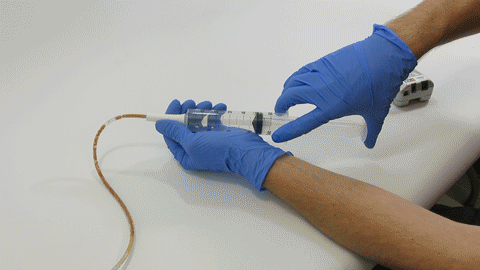 Syringe Force on Clogged Feeding Tubes